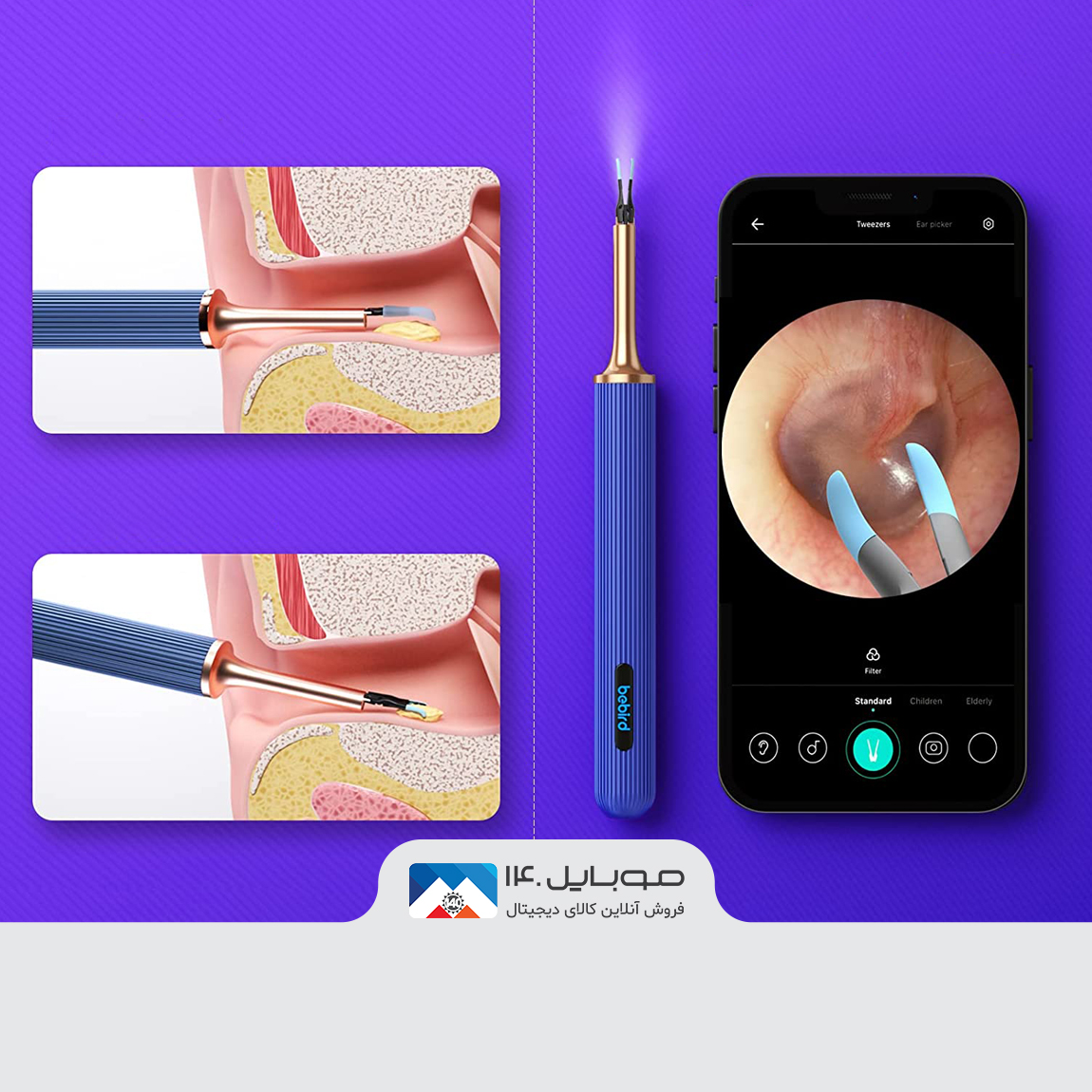 Xiaomi BebirdNote 3 pro max Ear Wax Removal Tool 4